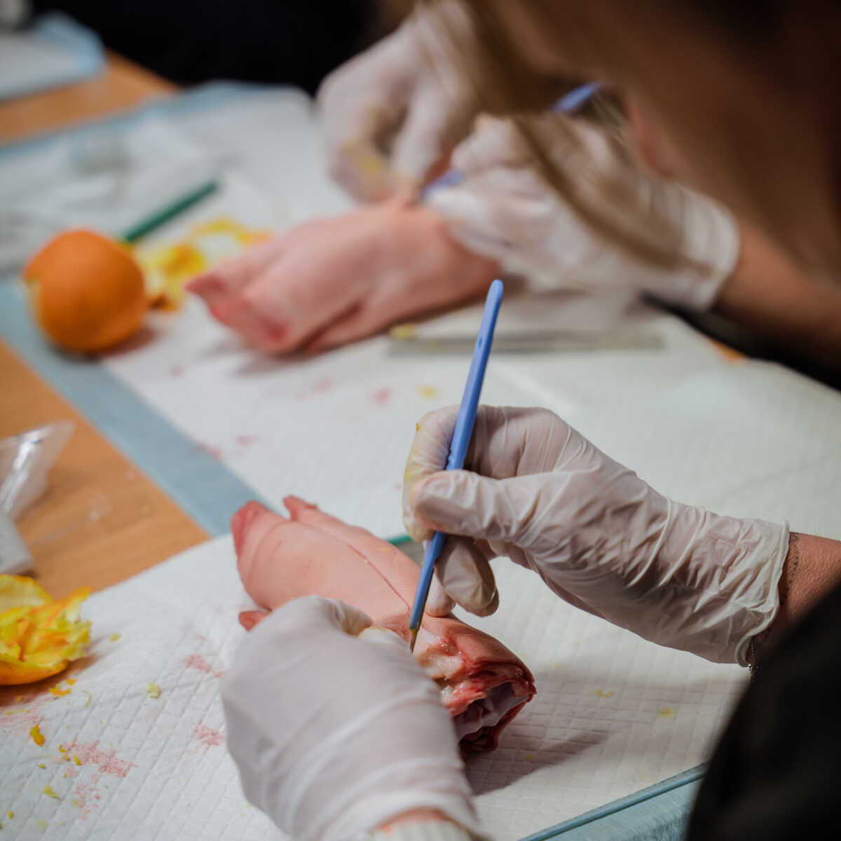 het belang van debridement in de wondzorg